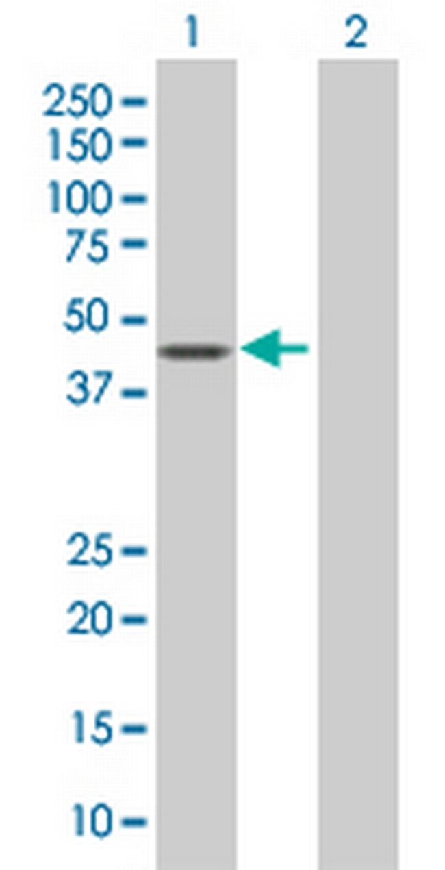 PUS1 Antibody in Western Blot (WB)