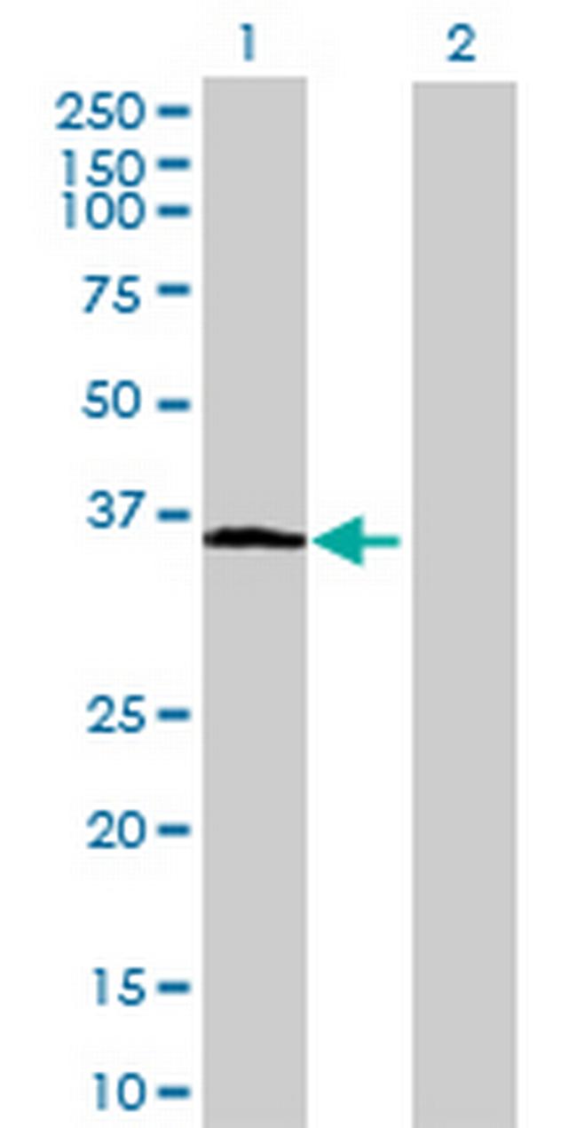 ABTB1 Antibody in Western Blot (WB)