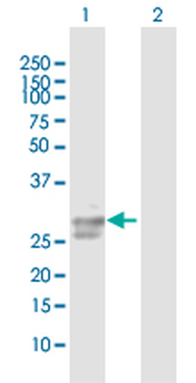 ULBP2 Antibody in Western Blot (WB)