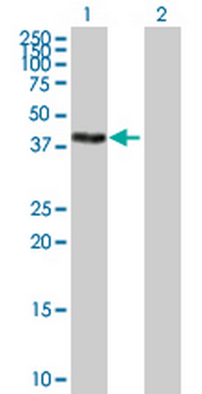 ZSCAN16 Antibody in Western Blot (WB)
