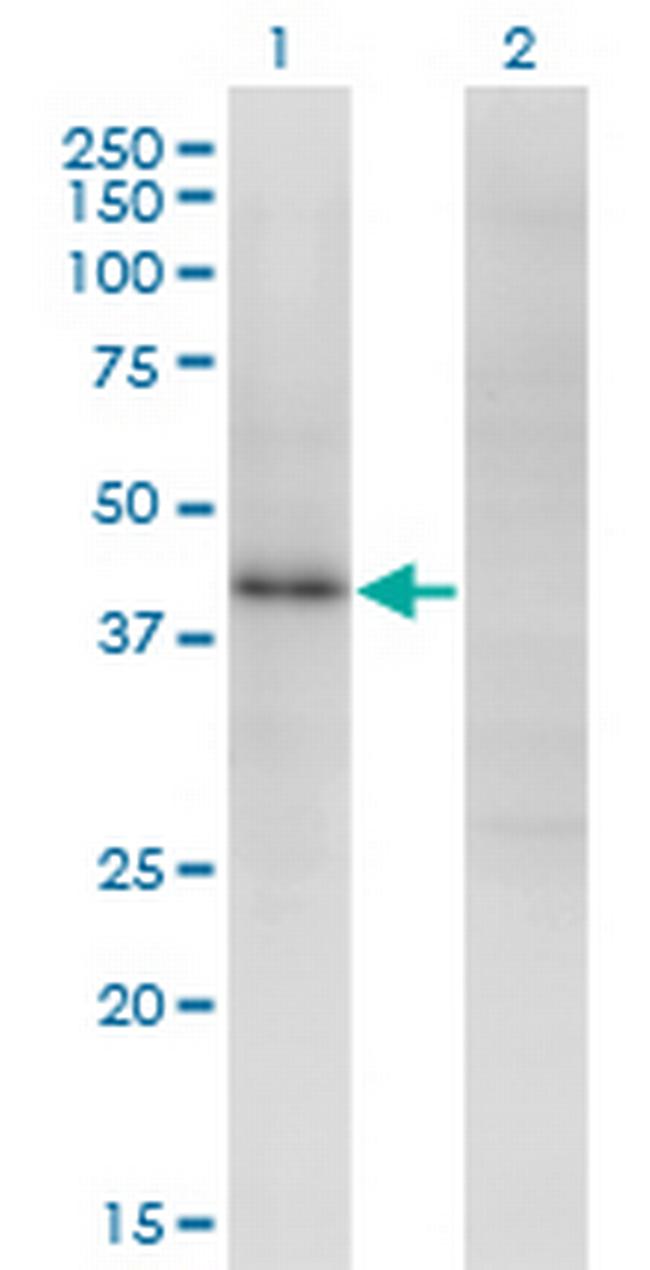 ZNF435 Antibody in Western Blot (WB)