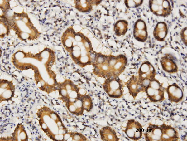 COASY Antibody in Immunohistochemistry (Paraffin) (IHC (P))