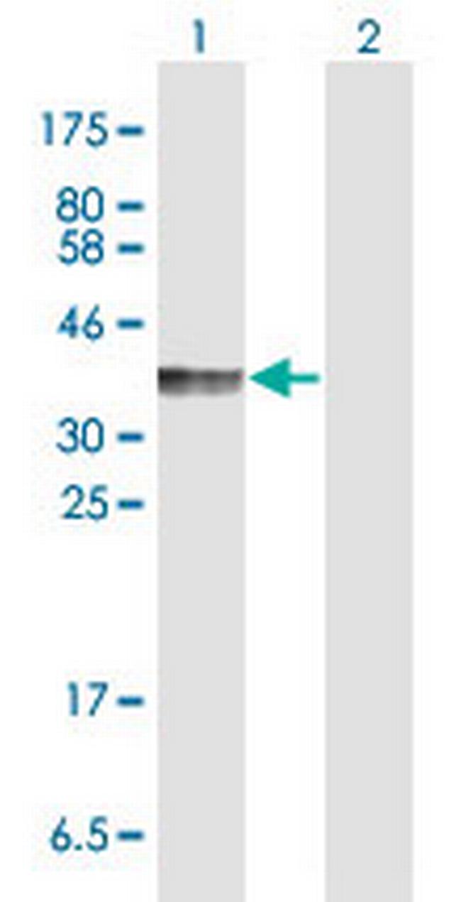 PDCD1LG2 Antibody in Western Blot (WB)