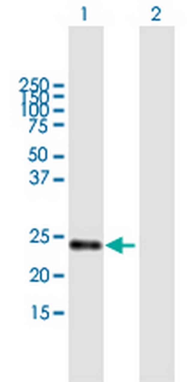 STARD5 Antibody in Western Blot (WB)