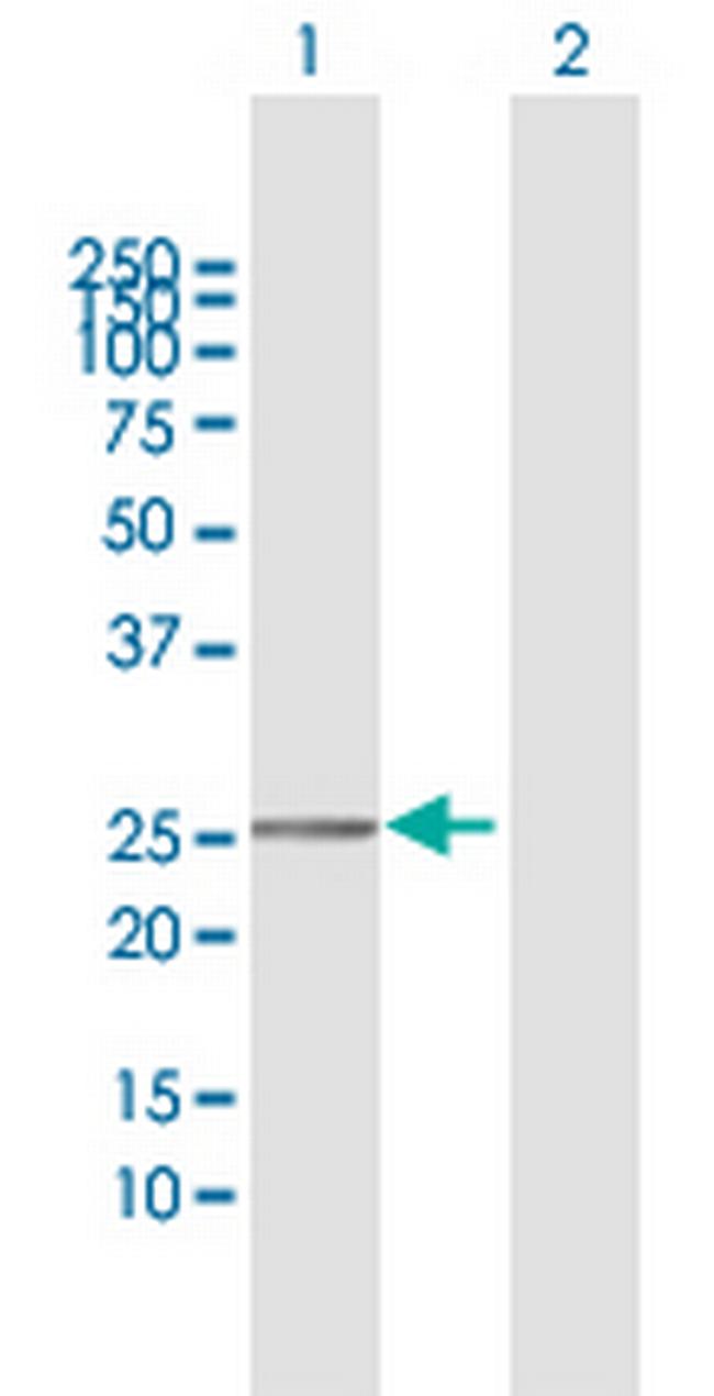 TMEM177 Antibody in Western Blot (WB)