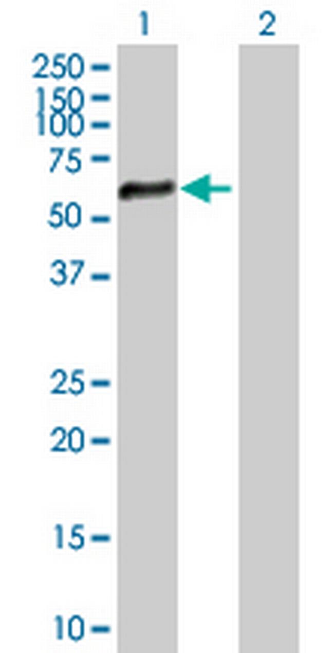 ZNF34 Antibody in Western Blot (WB)