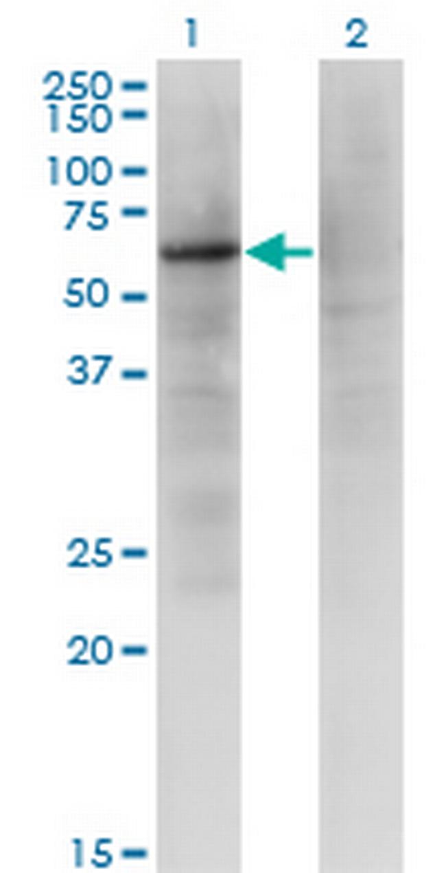 ZNF34 Antibody in Western Blot (WB)