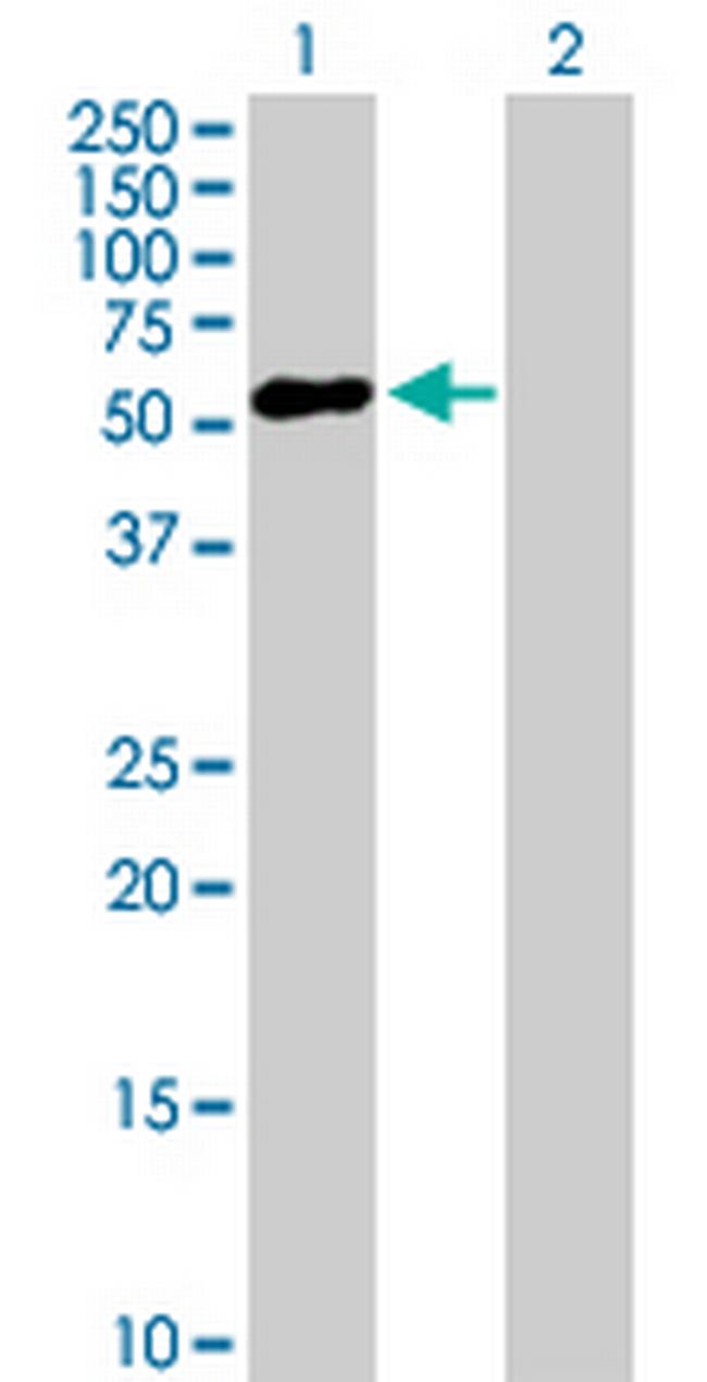 ZNF436 Antibody in Western Blot (WB)