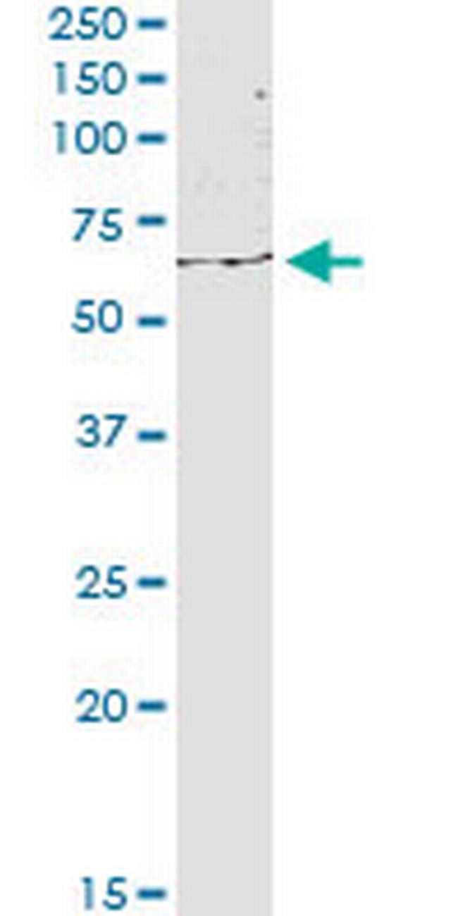 KIAA1706 Antibody in Western Blot (WB)