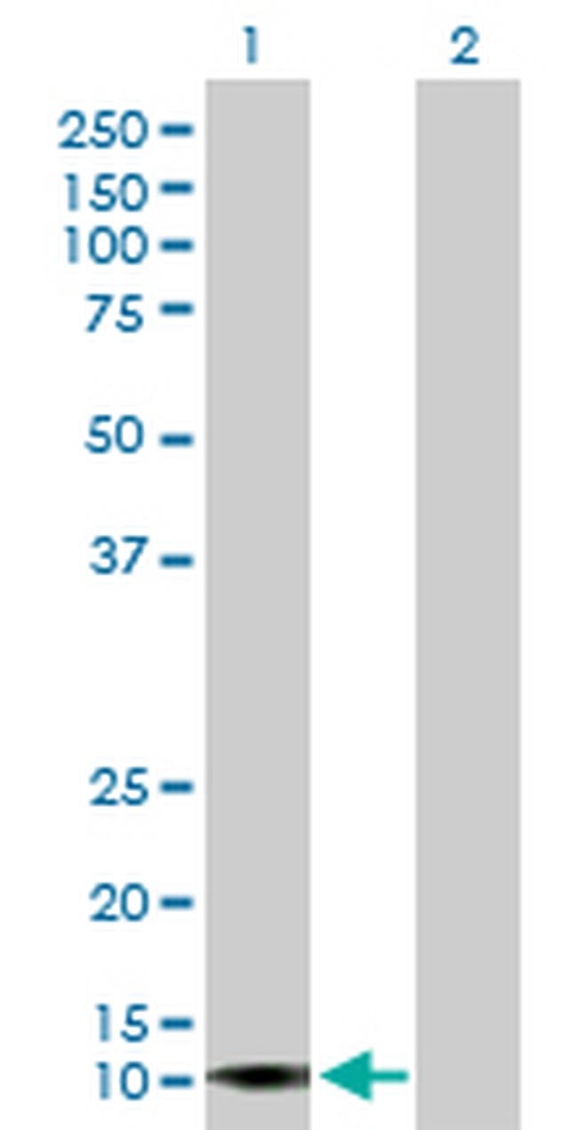 APOL4 Antibody in Western Blot (WB)