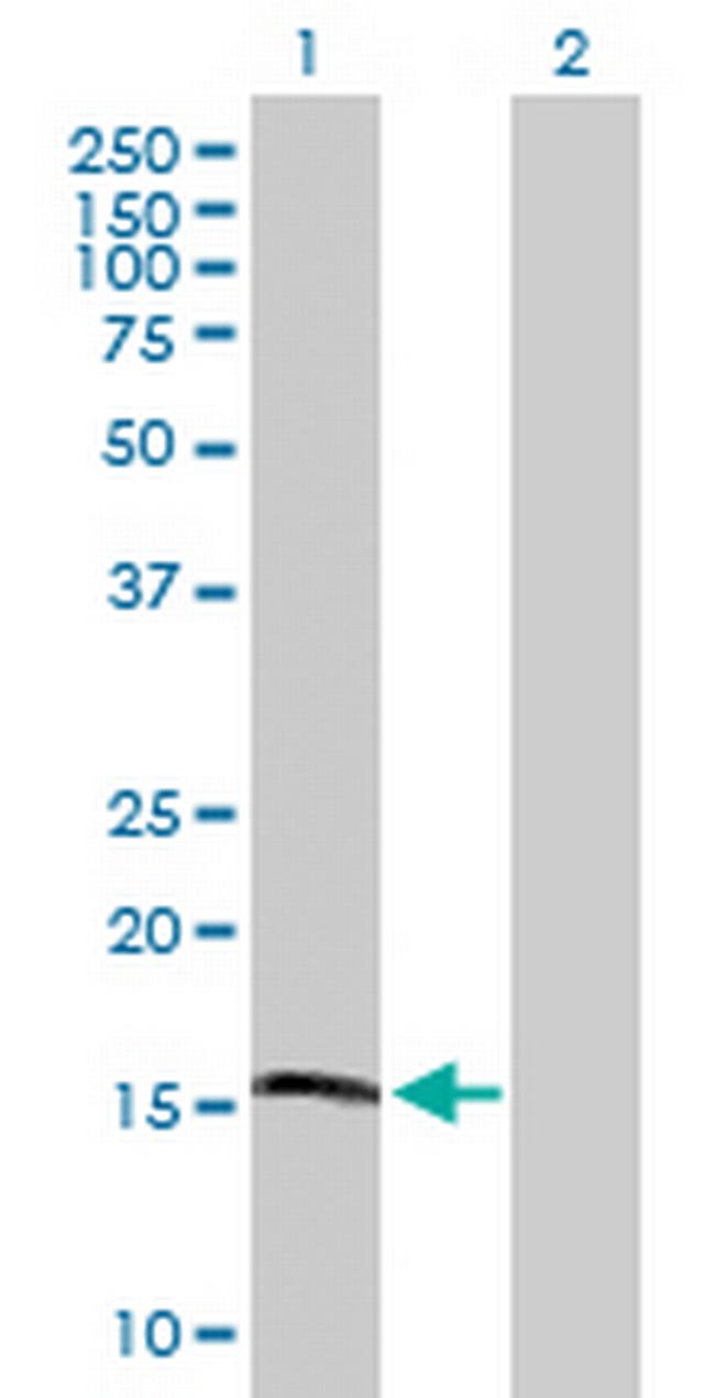 APOL4 Antibody in Western Blot (WB)
