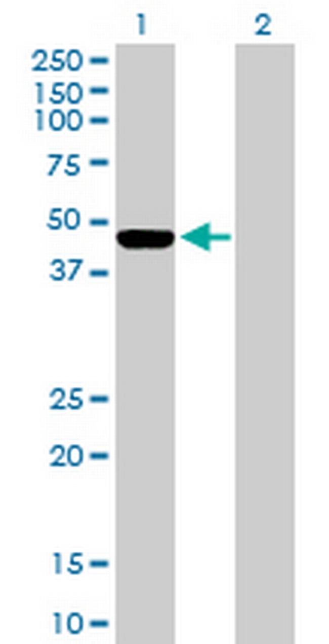 ILKAP Antibody in Western Blot (WB)