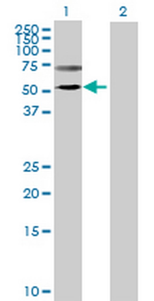 TMPRSS5 Antibody in Western Blot (WB)
