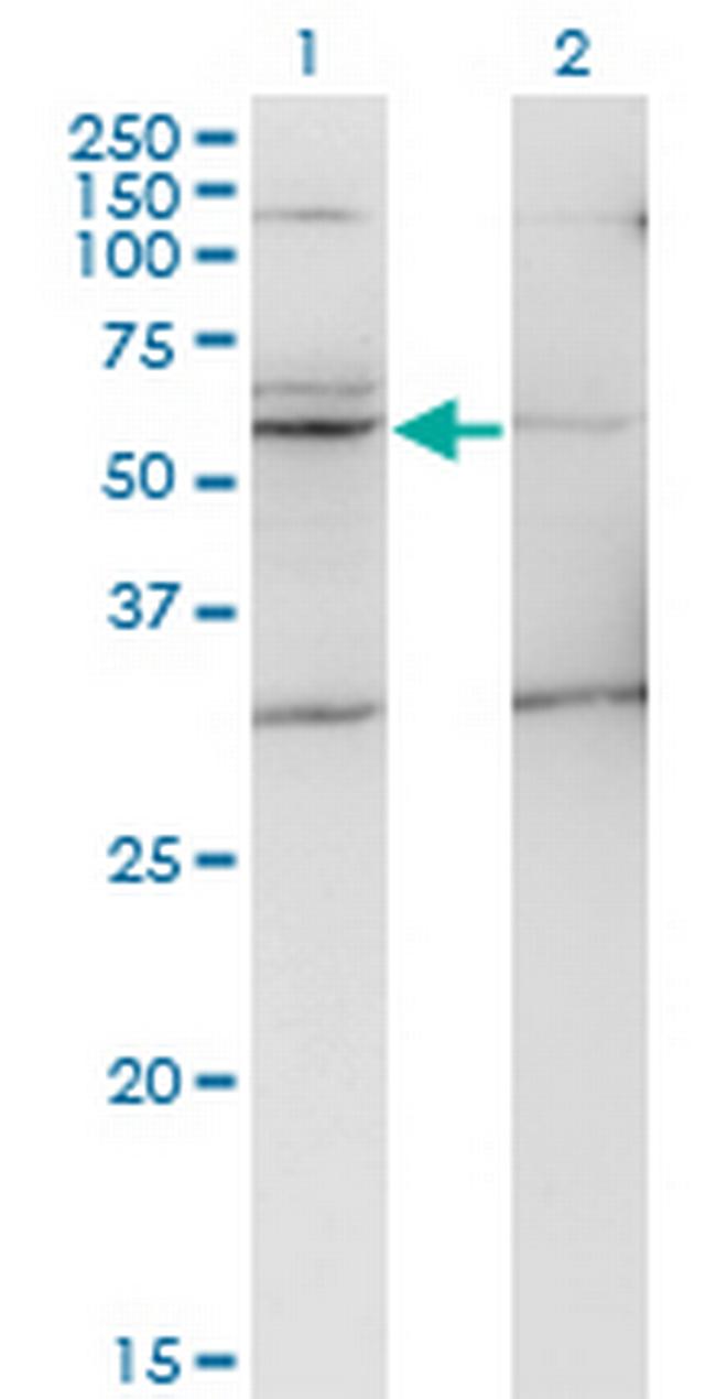 TMPRSS5 Antibody in Western Blot (WB)