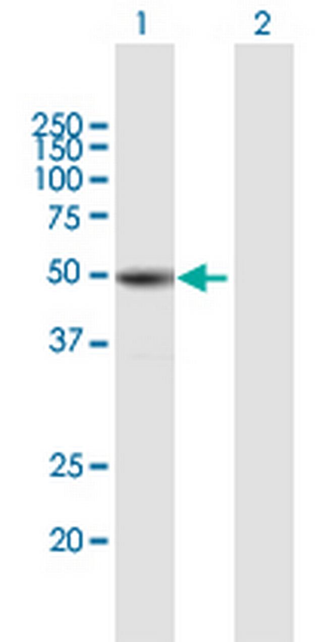 TUBB1 Antibody in Western Blot (WB)
