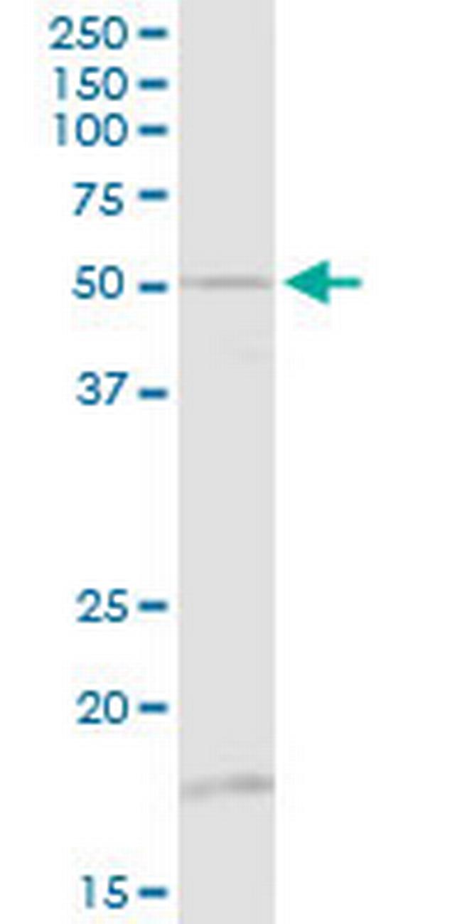 TUBB1 Antibody in Western Blot (WB)