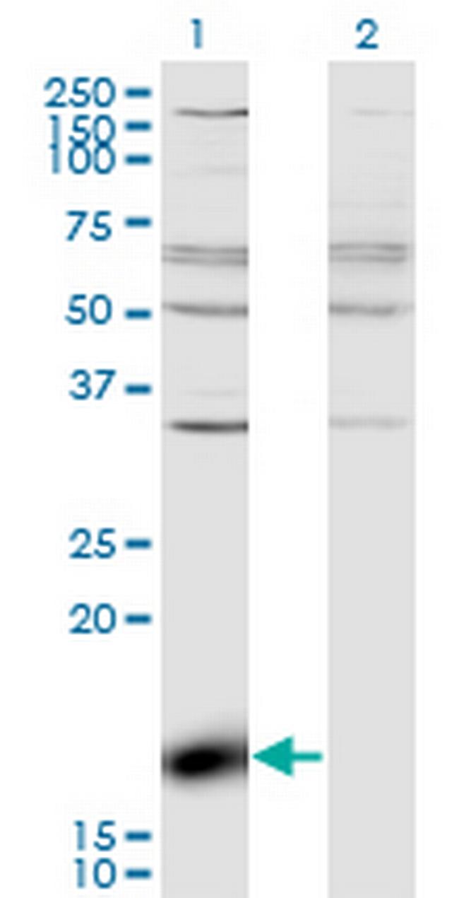 ZBP1 Antibody in Western Blot (WB)