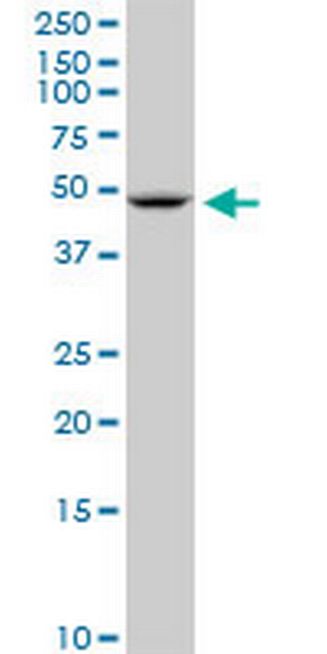 SLC2A10 Antibody in Western Blot (WB)