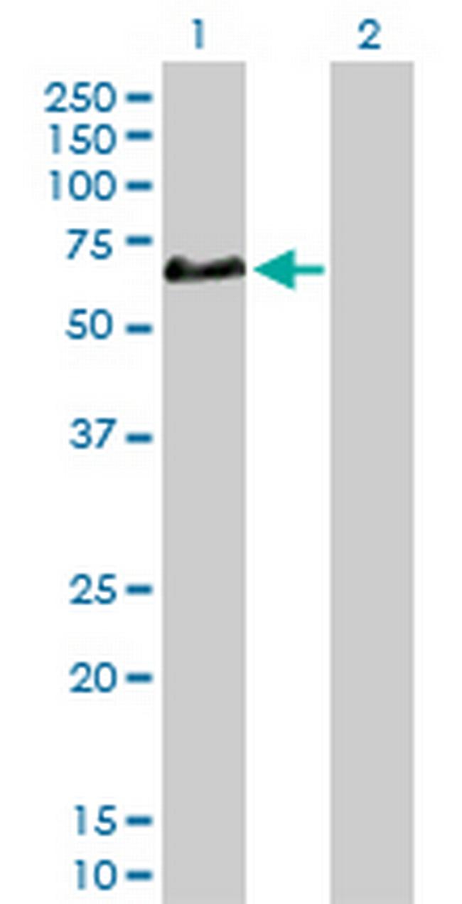 CFHR5 Antibody in Western Blot (WB)