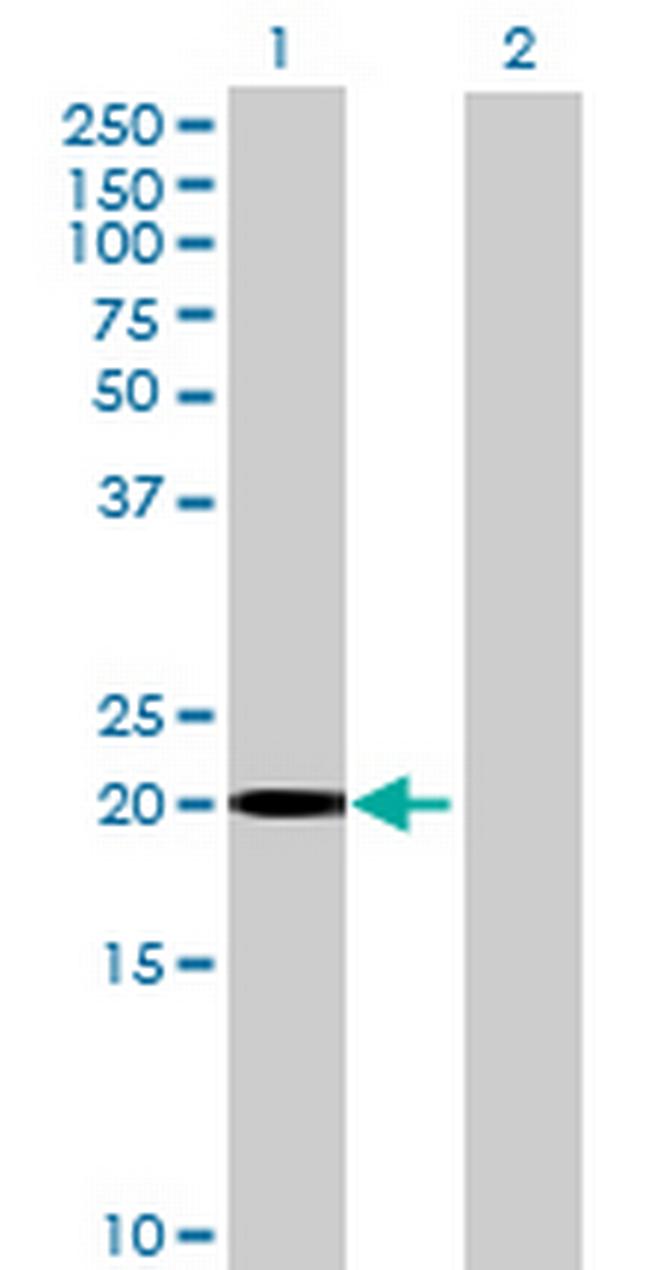 HCCA2 Antibody in Western Blot (WB)