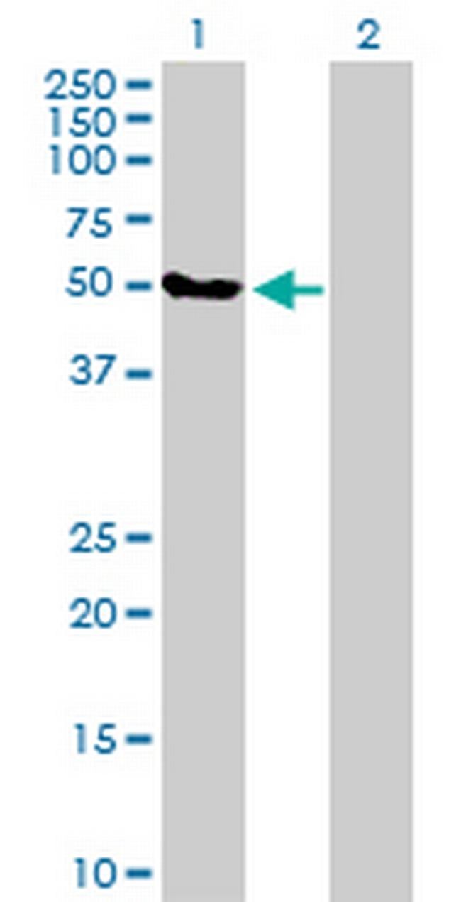FBXO38 Antibody in Western Blot (WB)