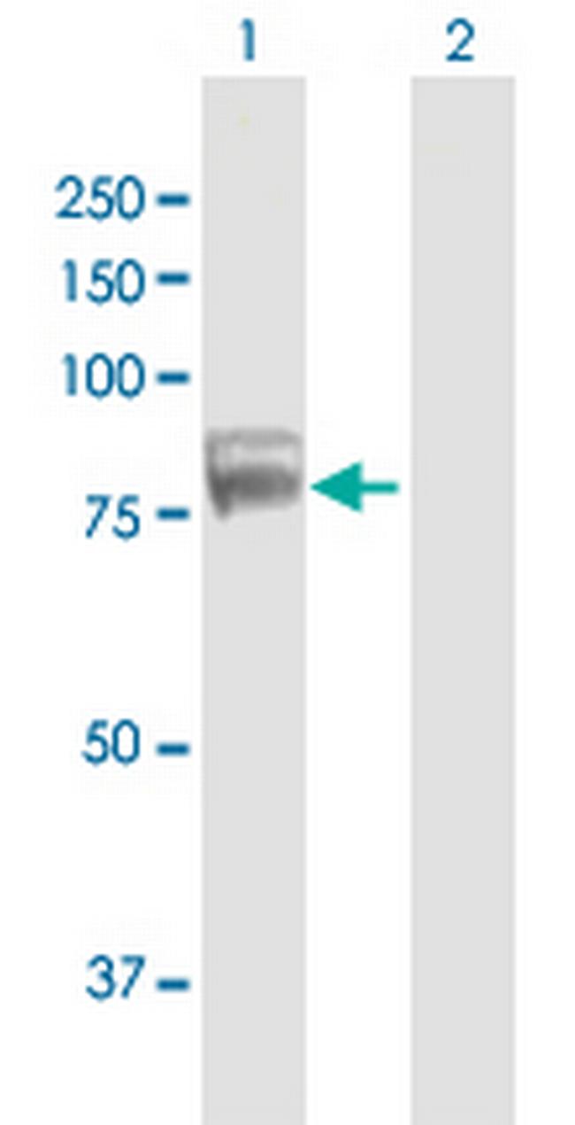 TDRD3 Antibody in Western Blot (WB)