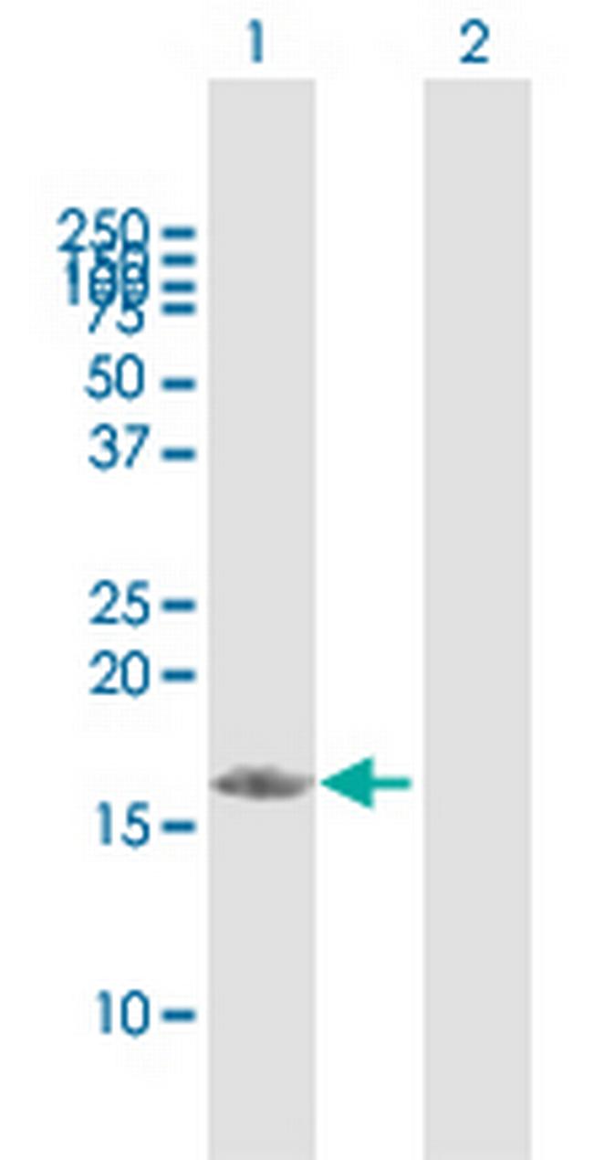 PDRG1 Antibody in Western Blot (WB)
