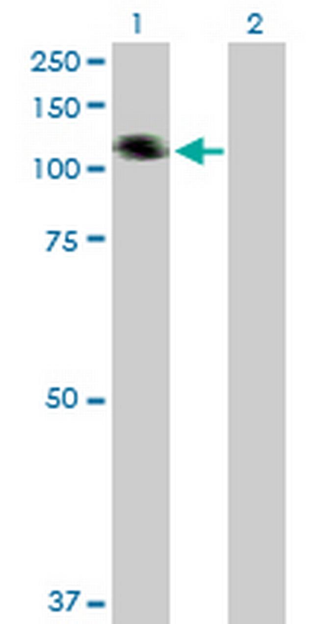 COL21A1 Antibody in Western Blot (WB)