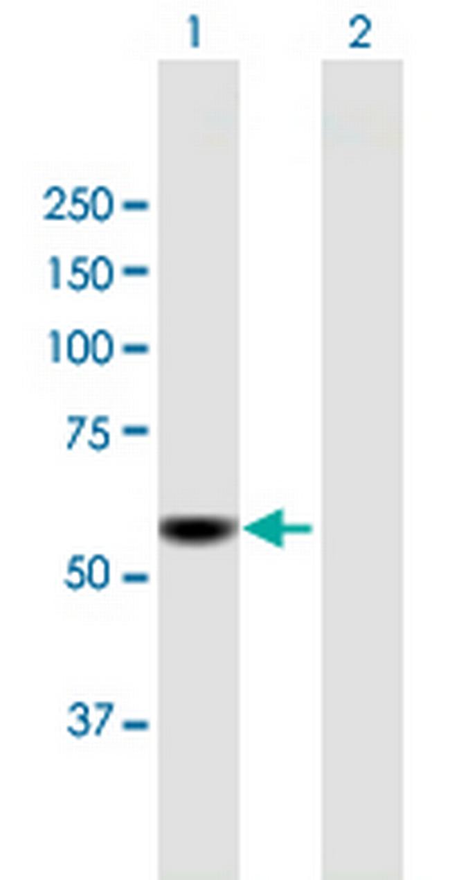 CDADC1 Antibody in Western Blot (WB)