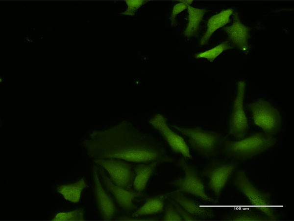 CDADC1 Antibody in Immunocytochemistry (ICC/IF)