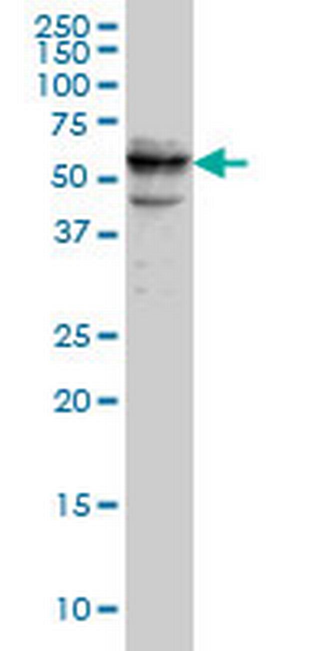 CDADC1 Antibody in Western Blot (WB)