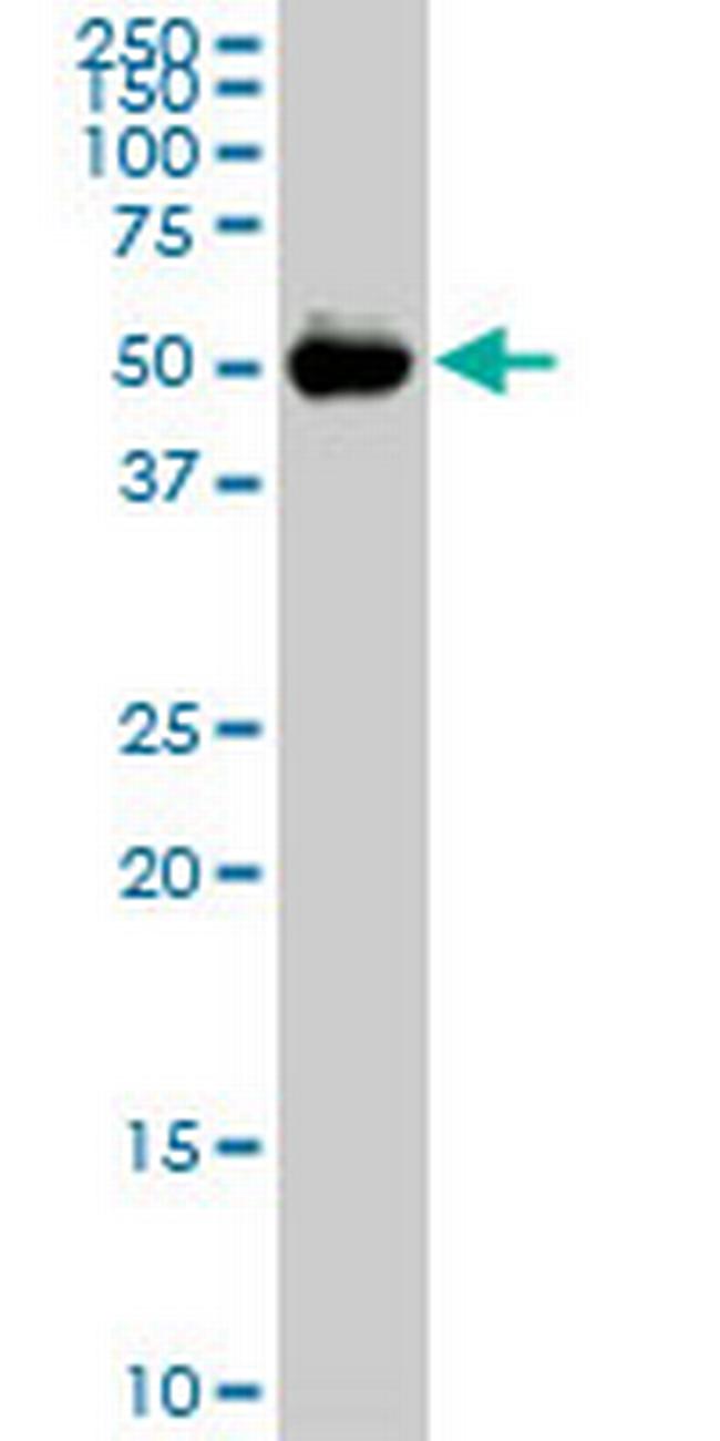 CDADC1 Antibody in Western Blot (WB)