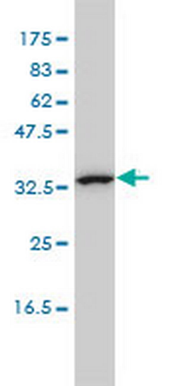 CAB39L Antibody in Western Blot (WB)