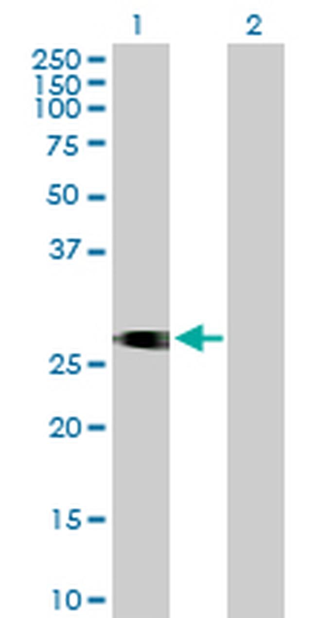 ITM2C Antibody in Western Blot (WB)