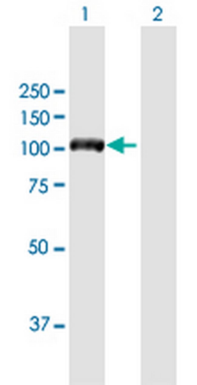 DIAPH3 Antibody in Western Blot (WB)