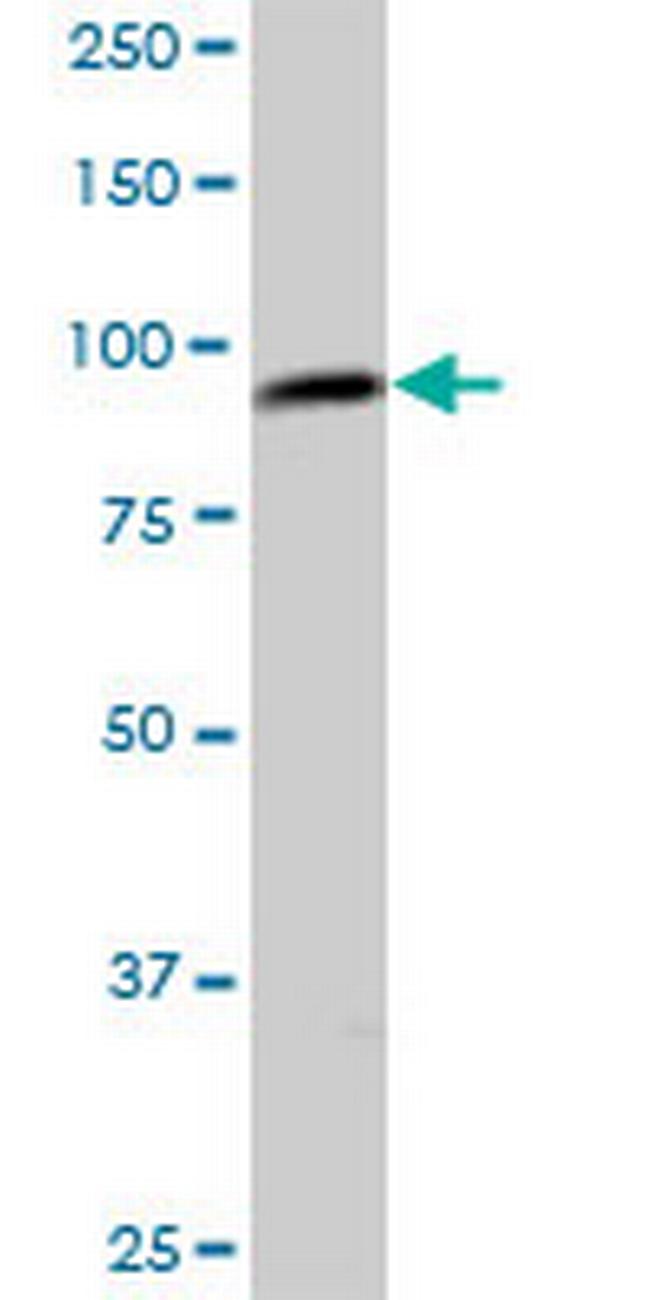 C1orf25 Antibody in Western Blot (WB)