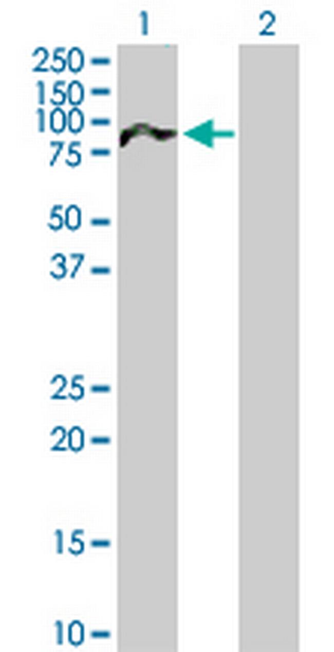 NUAK2 Antibody in Western Blot (WB)