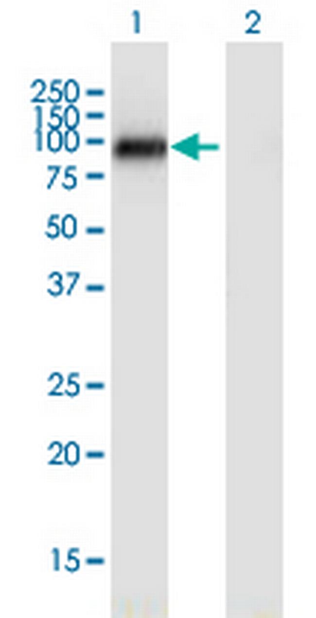 NUAK2 Antibody in Western Blot (WB)