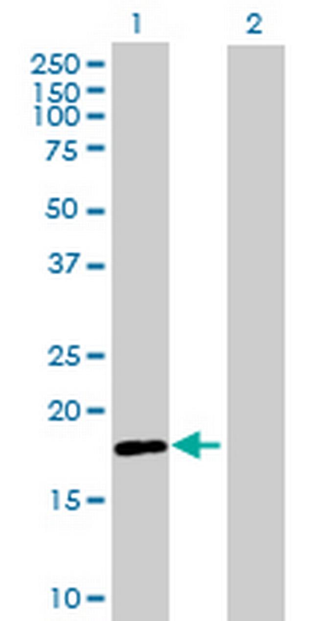 RNF170 Antibody in Western Blot (WB)