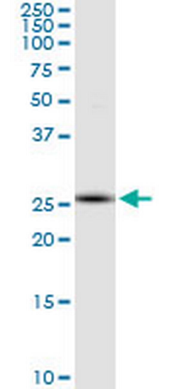 RNF170 Antibody in Western Blot (WB)