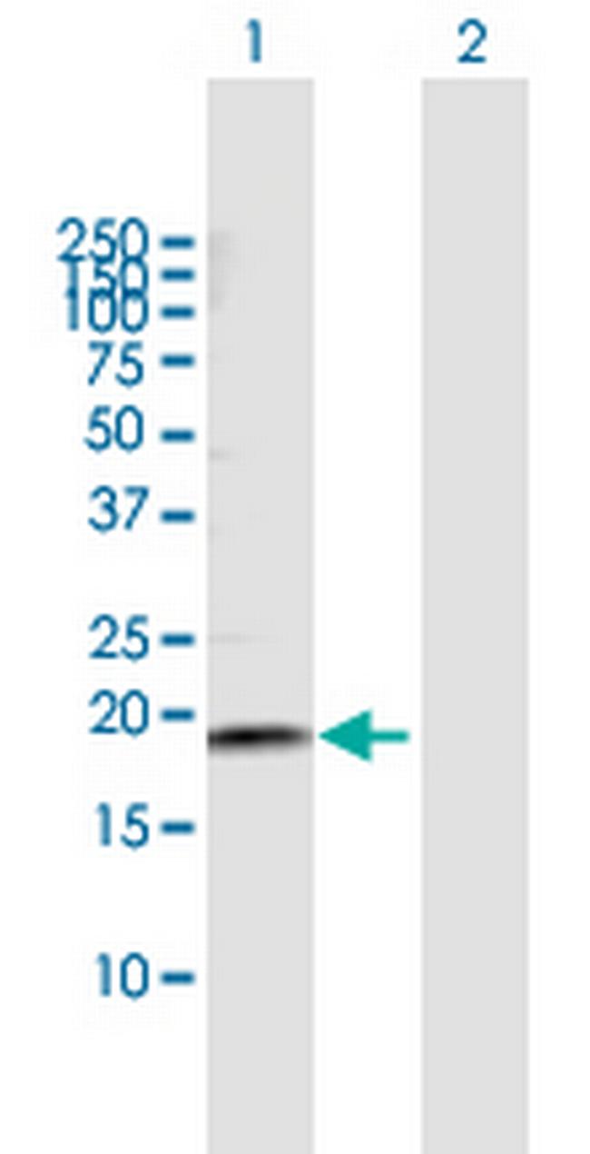 NETO2 Antibody in Western Blot (WB)