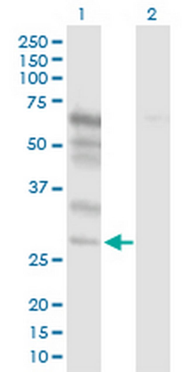 NETO2 Antibody in Western Blot (WB)