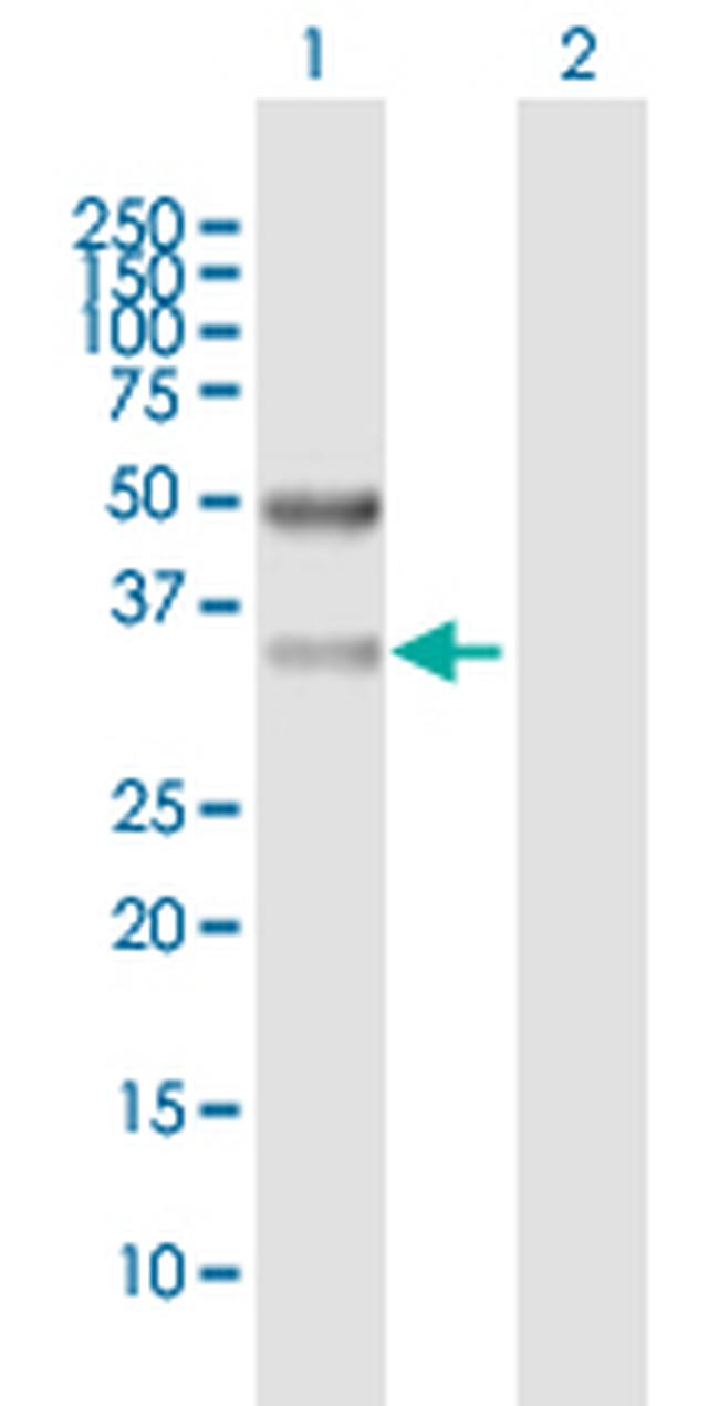 SFXN3 Antibody in Western Blot (WB)