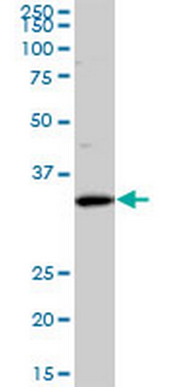 SFXN3 Antibody in Western Blot (WB)