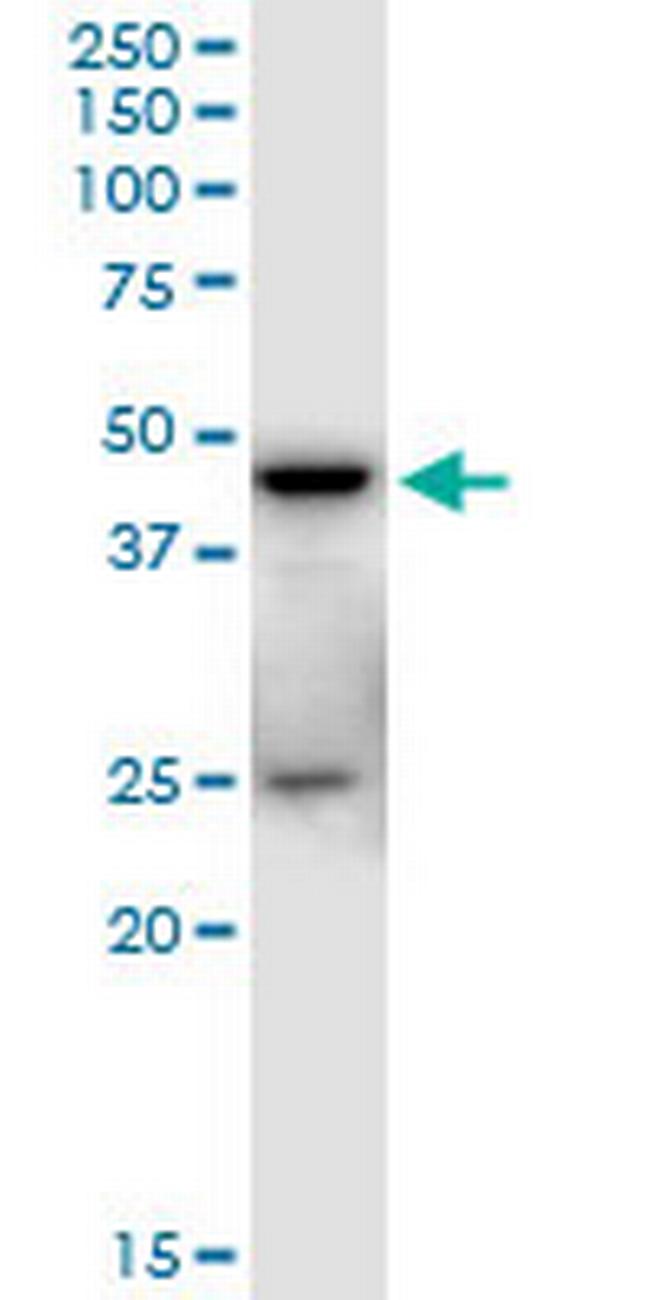 SHARPIN Antibody in Western Blot (WB)