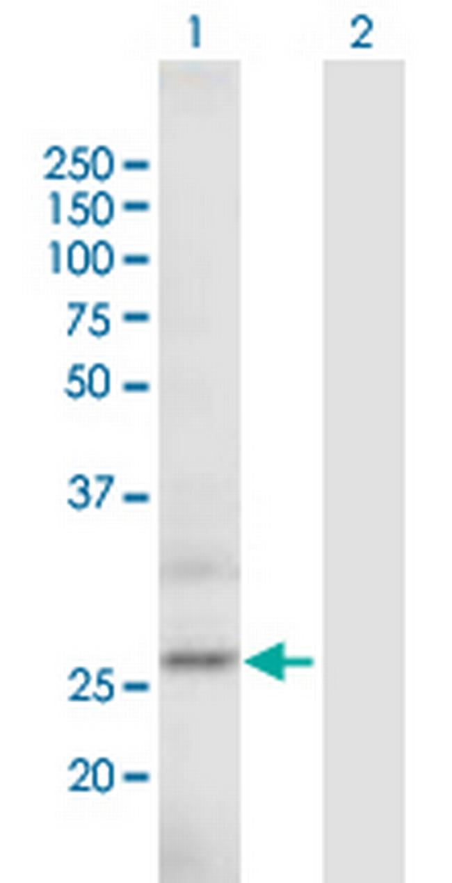 ARPC5L Antibody in Western Blot (WB)
