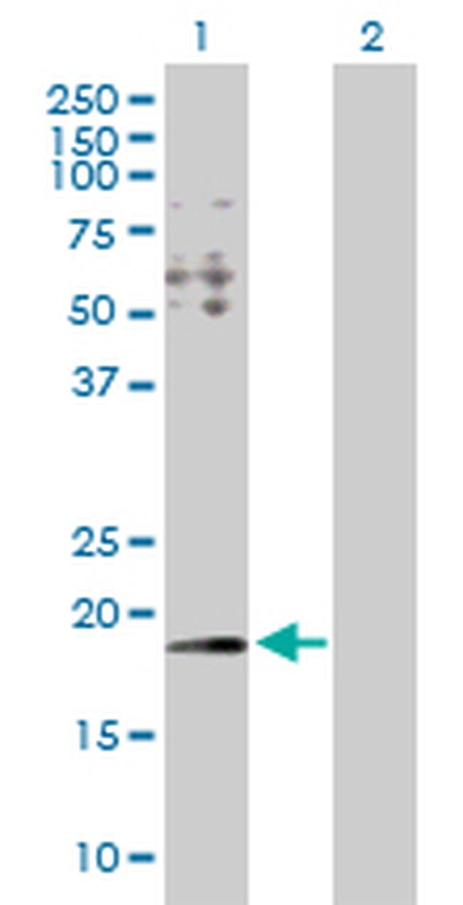 HYI Antibody in Western Blot (WB)
