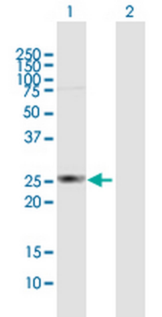 HDHD3 Antibody in Western Blot (WB)