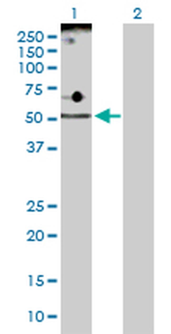 ADPGK Antibody in Western Blot (WB)