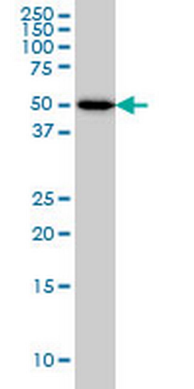 ADPGK Antibody in Western Blot (WB)